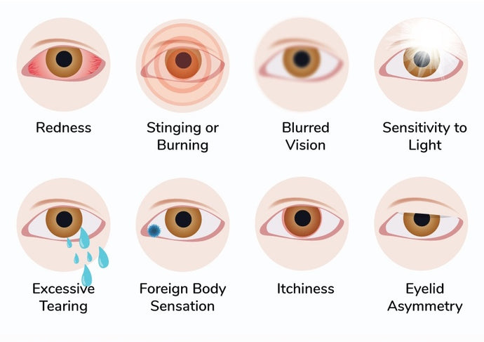 โรคตาแห้ง 8 อาการของตาแห้ง ที่ไม่ควรมองข้าม