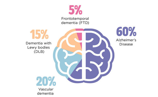 ภาวะสมองเสื่อม : อาการ, ประเภท, ระยะ, การรักษาและการป้องกัน